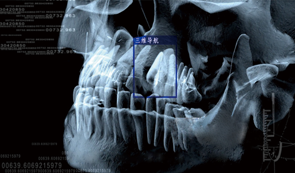 三维CT口腔影像数据捕获